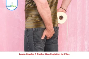 Rubber Band Ligation for Piles