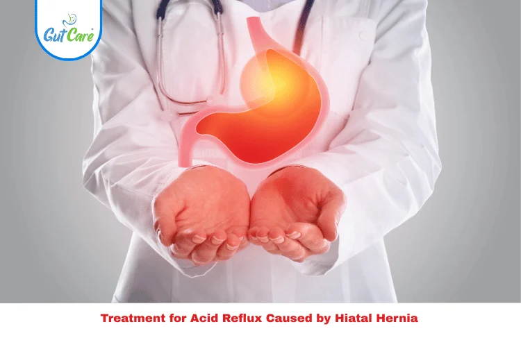 Treatment for Acid Reflux