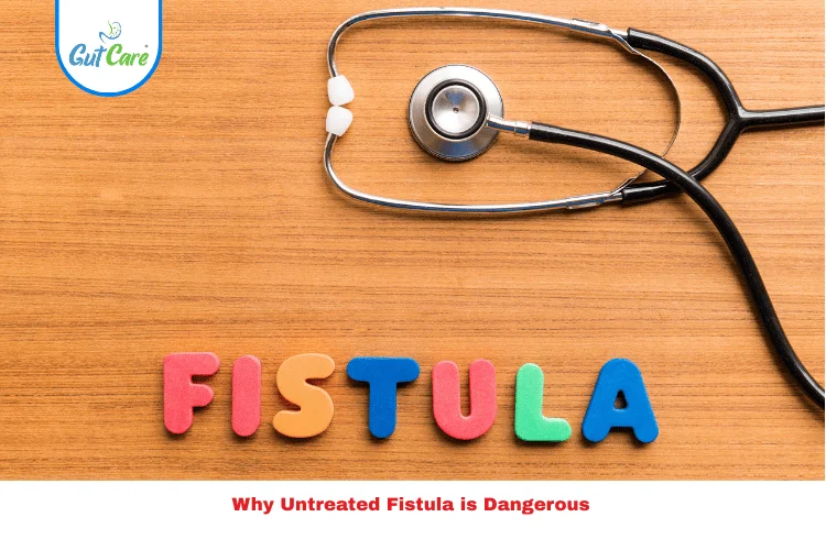 Untreated Fistula
