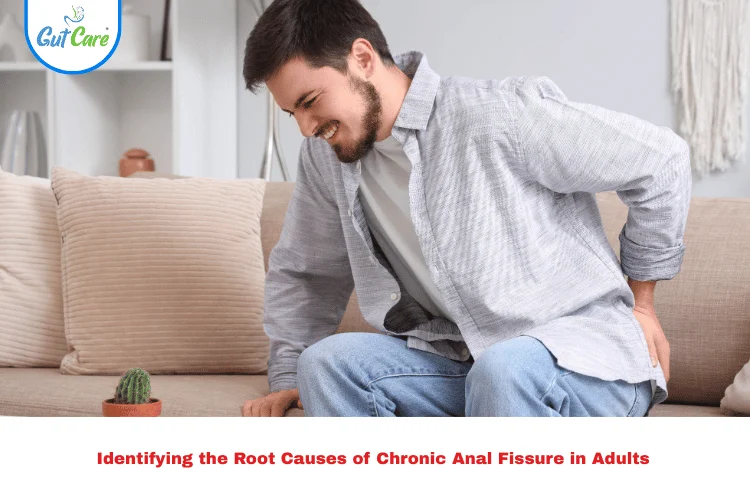 Chronic Anal Fissure in Adults