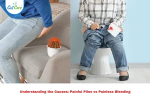Painful Piles vs Painless Bleeding