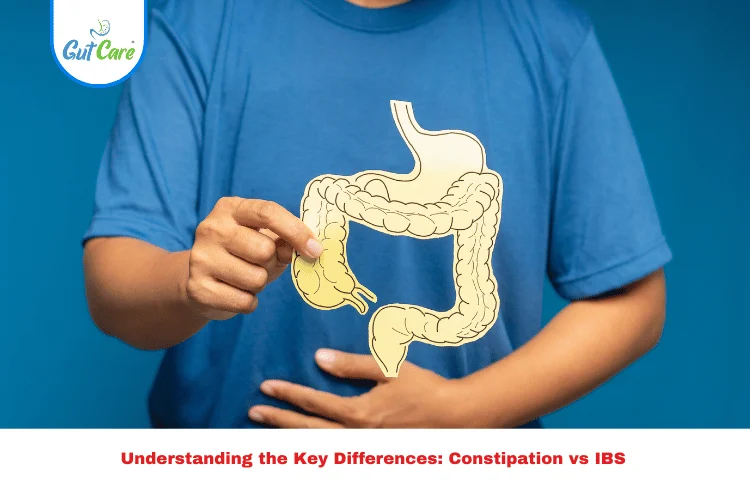 Constipation vs IBS
