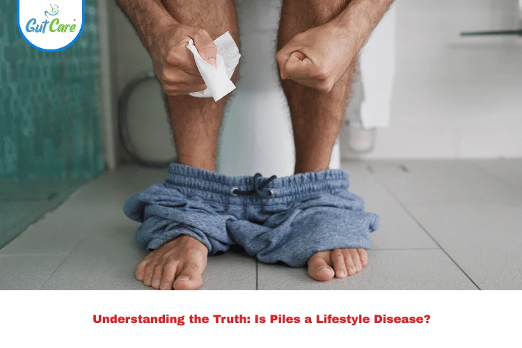 Piles a Lifestyle Disease,