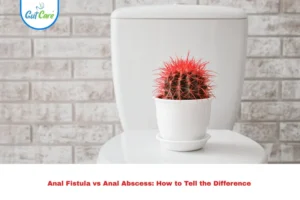 Anal Fistula vs Anal Abscess