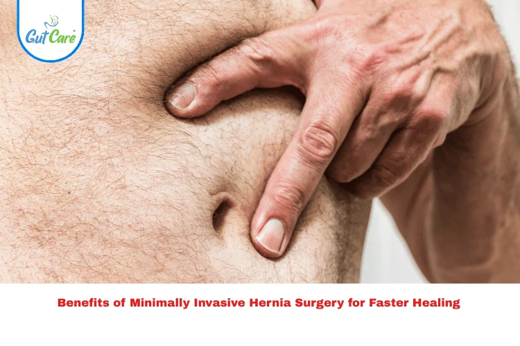 Minimally Invasive Hernia Surgery