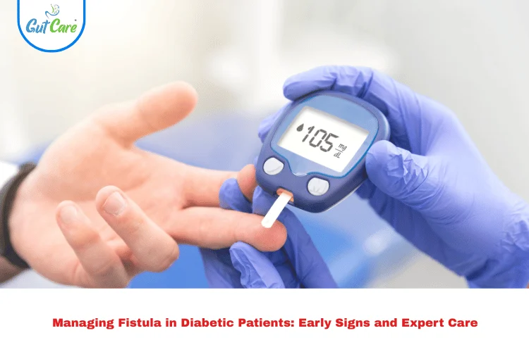 Fistula in Diabetic Patients