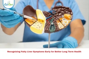 Fatty Liver Symptoms
