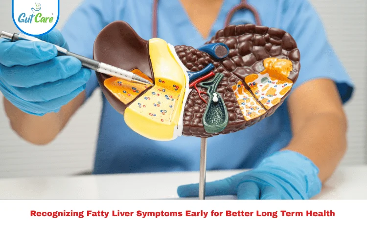Fatty Liver Symptoms