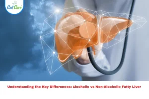 alcoholic vs non-alcoholic fatty liver