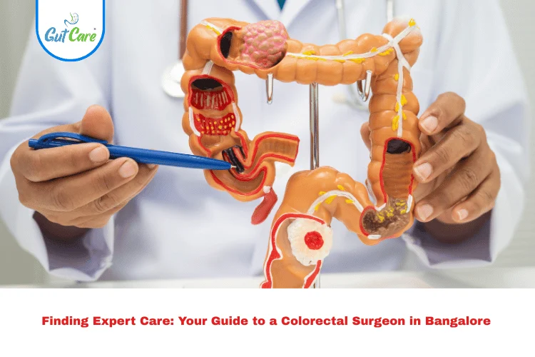 Colorectal Surgeon in Bangalore