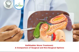 Gallbladder Stone Treatment