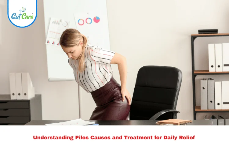 Piles Causes and Treatment