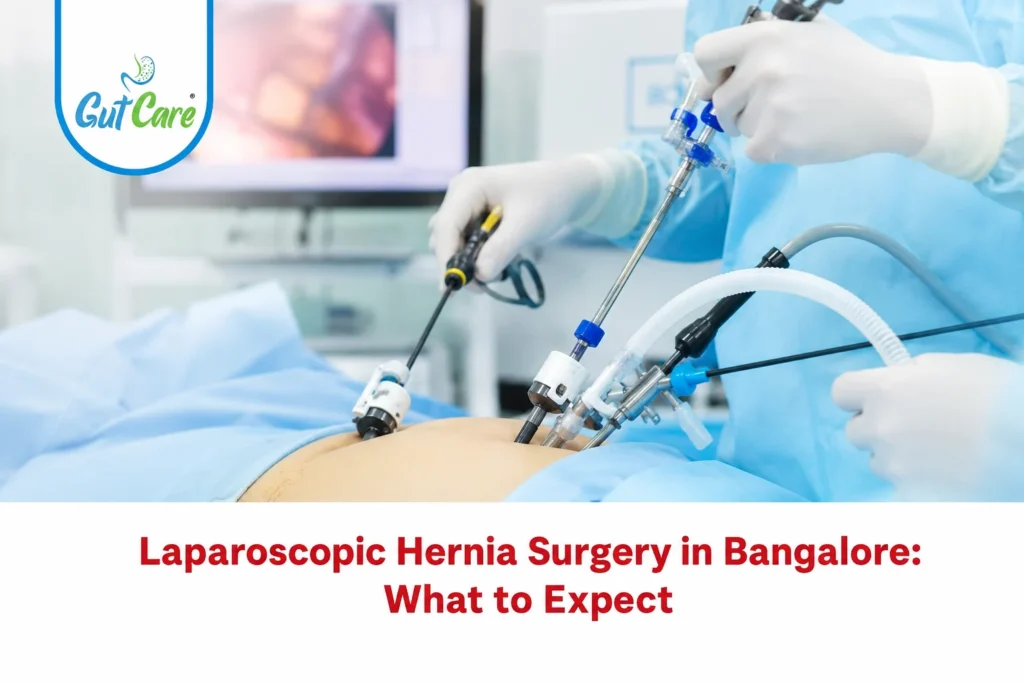 laparoscopic hernia surgery in bangalore