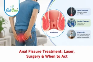 anal fissure treatment in Bangalore