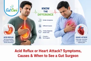 acid reflux treatment in Bangalore