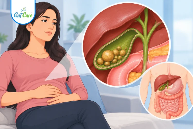 gallstones without pain